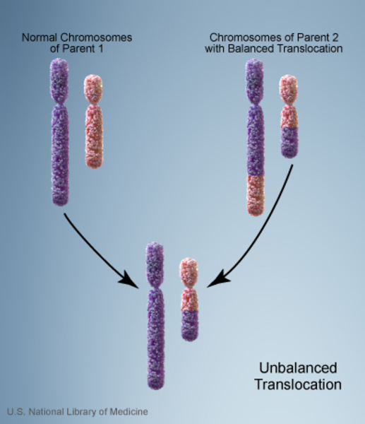 Görsel 7: Dengesiz translokasyon/NCBI