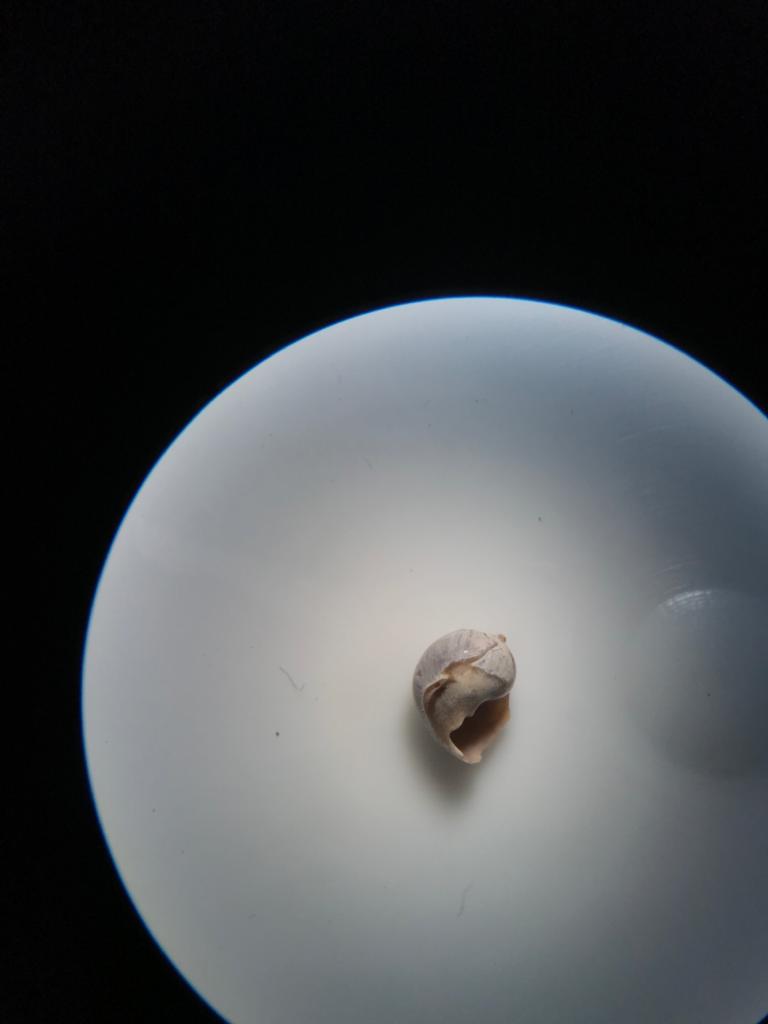 Görsel 2: Tritia neritea mikroskop görüntüsü.