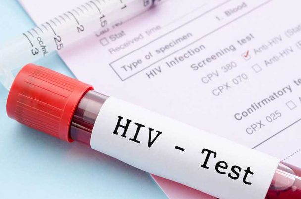 Herpes (HSV) Testi Nedir?