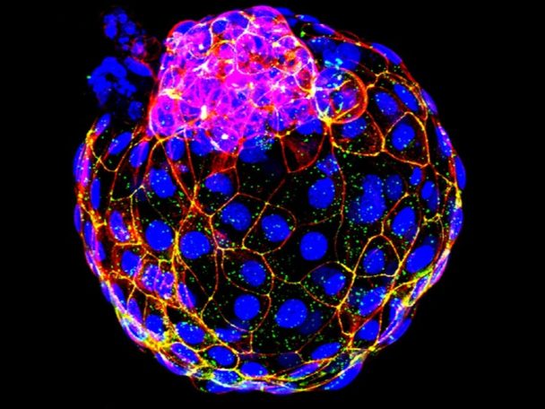 Bilim İnsanlarının Keşfi: Kök Hücrelerin Kimliklenme Mekanizması